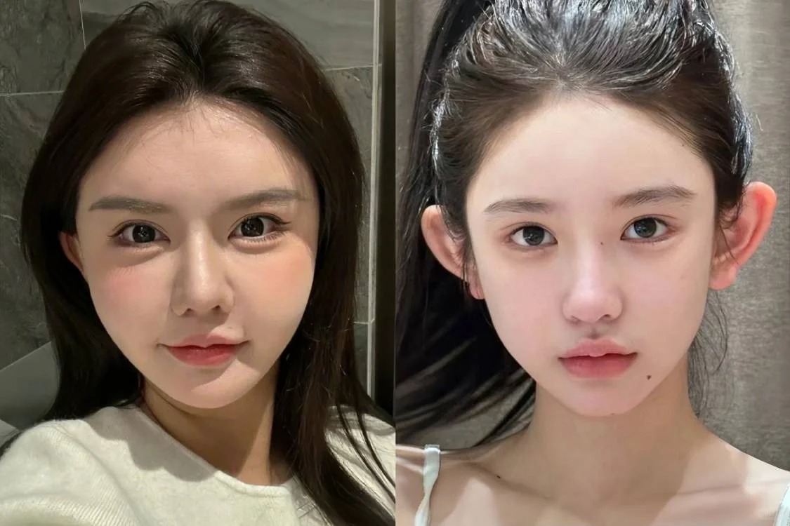 同样是饱满脸，为什么左边一眼假