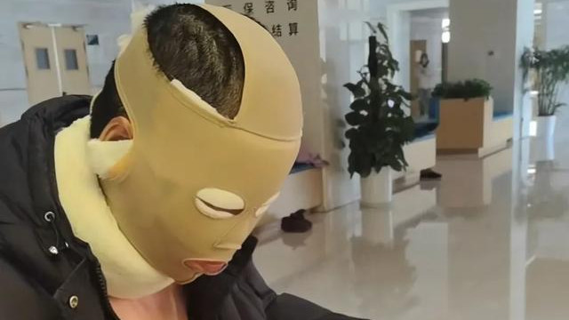 烧伤妈妈努力练习生活技能，身体部位开始增厚长疤，看起来很心疼