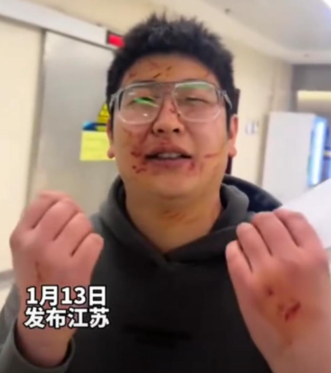 儿子被后妈叫人打伤，父亲以死相逼要儿子和解，知情人透露：后妈很年轻！