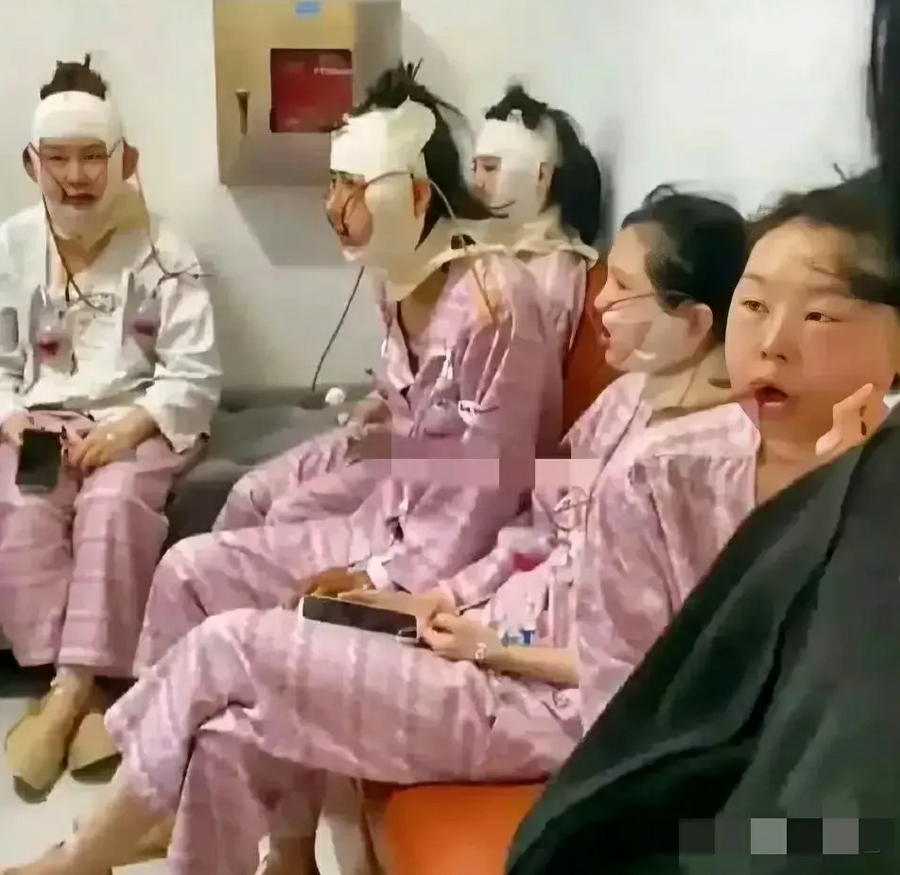 现在的整容风越刮越邪乎了！如果我没猜错的话，这些女人做的整容手术是削骨瘦脸，她们