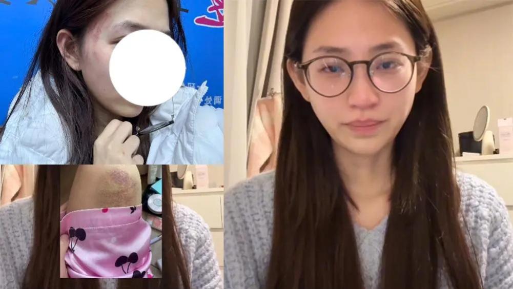 鸡腿诺控诉男友程鑫凯家暴，却因一疏忽遭反转！逆天发言被嘲捞女