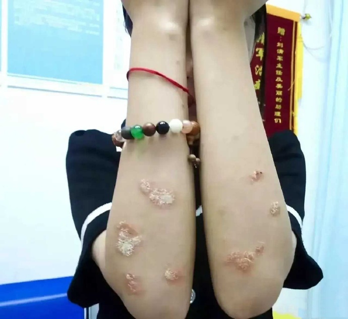 这样的病，去医院挂什么科？还能治好吗？ ​​​