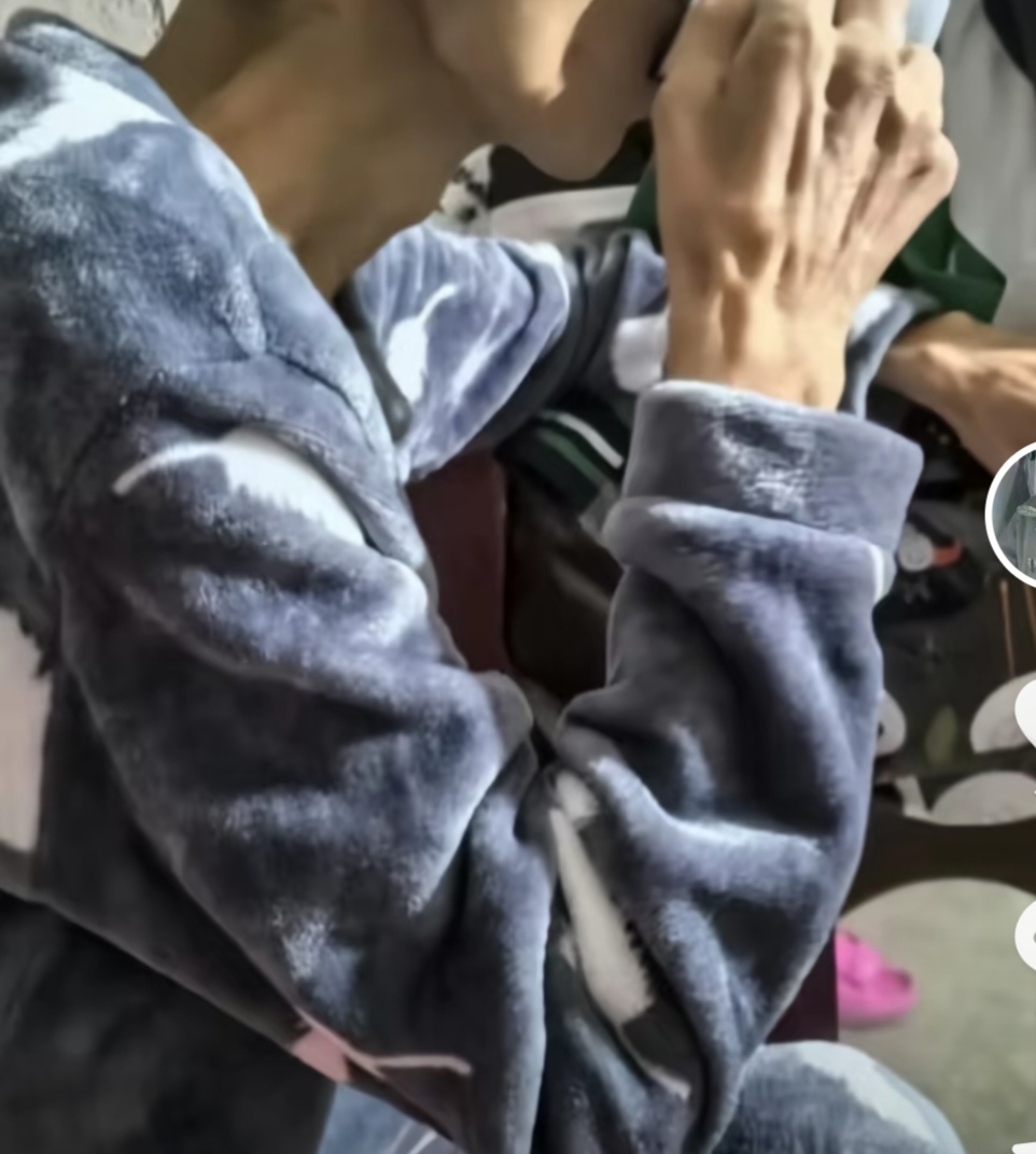女子记录老公抗癌过程，确诊半年从120多斤到骨瘦如柴
