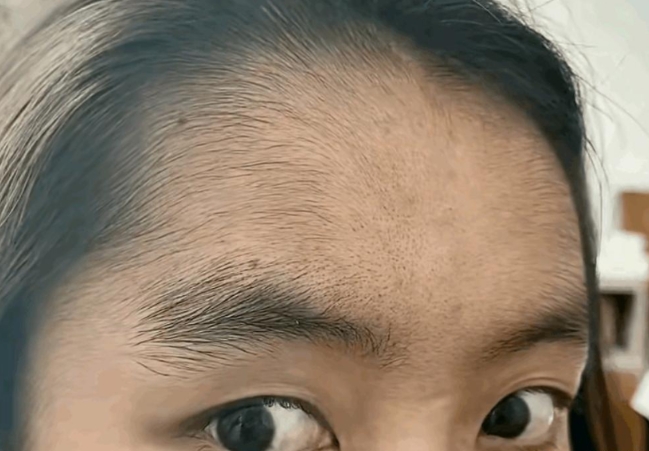 这发际线你羡慕吗？