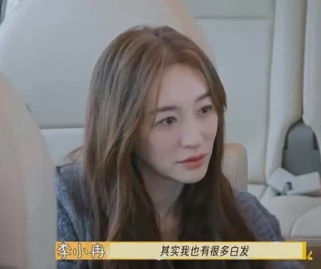 李小冉的白发确实挺让人疑惑的