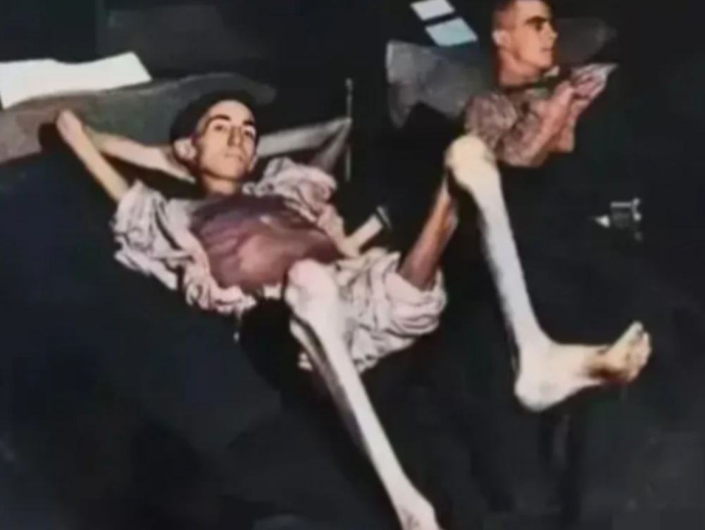 1945年，被德军俘虏的美国士兵约瑟夫·戴姆勒被解救时，已是只剩下皮包骨头了，虚