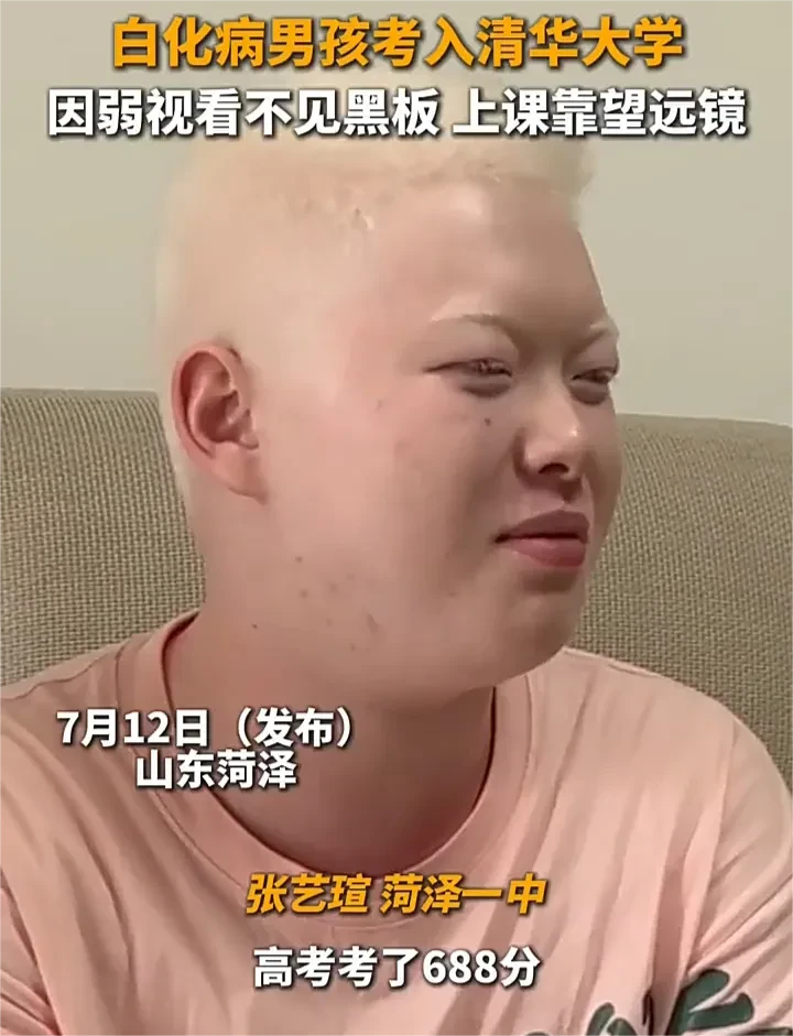 7月12日，山东一名患有先天性白化病的男孩，宣布自己成功上岸清华大学。据悉，这个