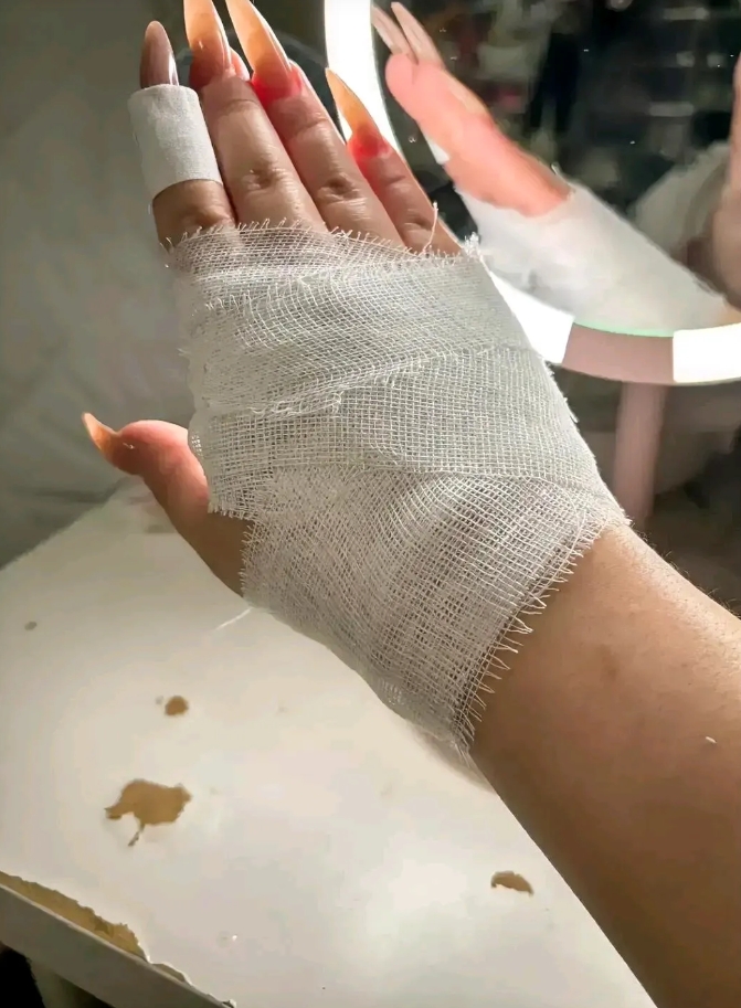 今天太憋屈了。想着给婆婆搭把手做饭，结果闹得一肚子委屈。让我切土豆丝，我切成了土