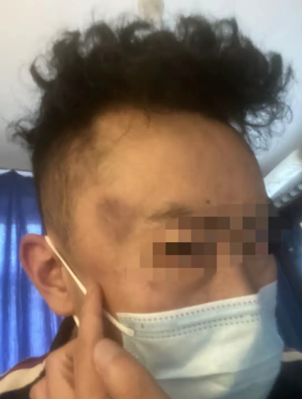 和被害人无冤无仇，三个警员竟然把人打成这样，实在是太没有人性了，必须依法严惩，绝