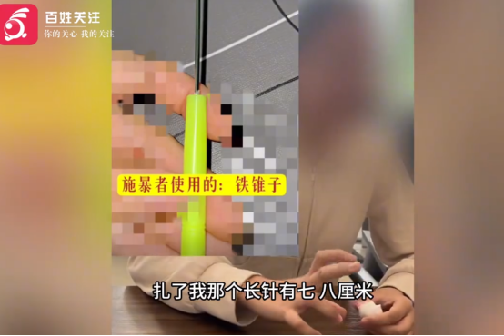 “我真的想死在学校里面！”山东济南，一家长发现自己女儿的校服上面全是针孔，掀开衣