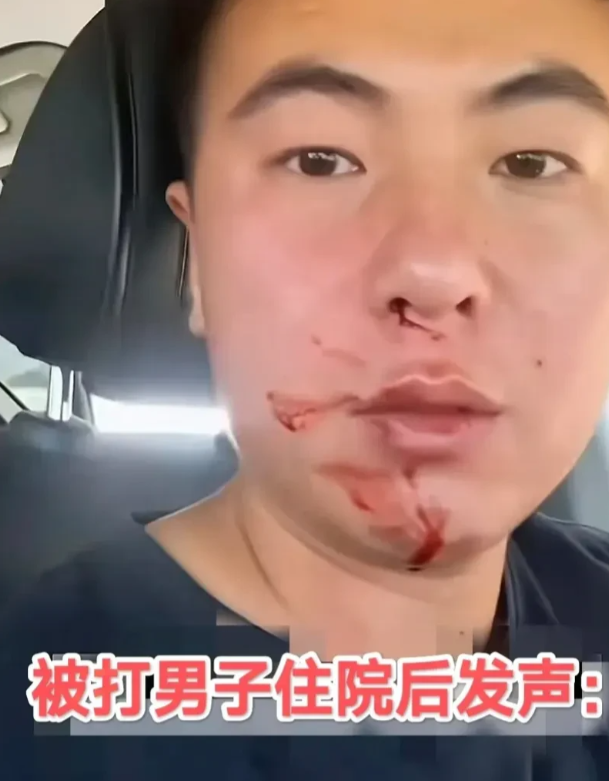 青岛一名遭袭入院的男性受害者，在出院初期公开发声，提出了以下六个核心观点：

1