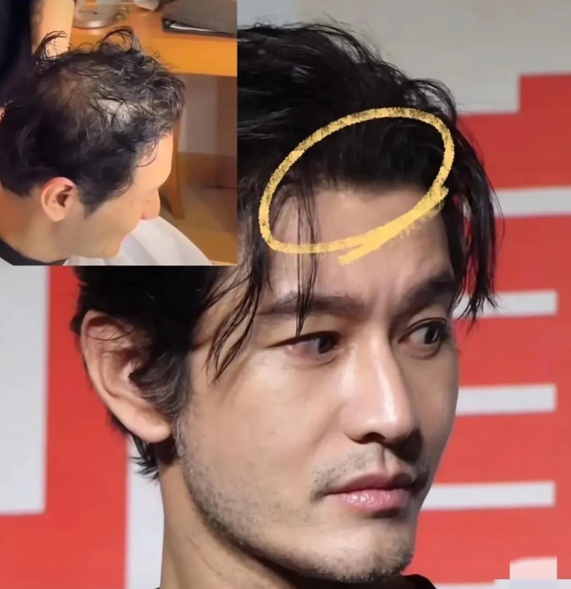 黄晓明从头到脚有两个硬伤，

黄晓明，这位曾经被无数影迷追捧的帅气男星，却在荧幕