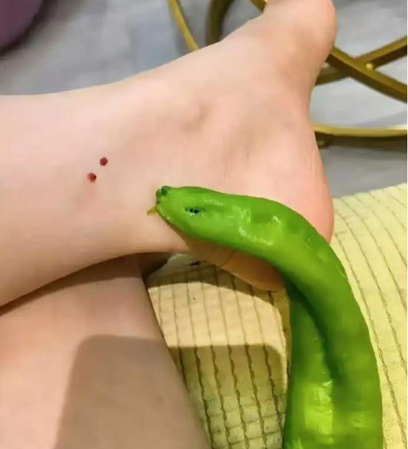 在线等，朋友被这个蛇咬了，需要挂什么科？
