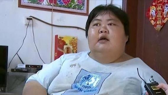 16年356斤“江门第一胖”，成功减重231斤，可丈夫却永远离开了她