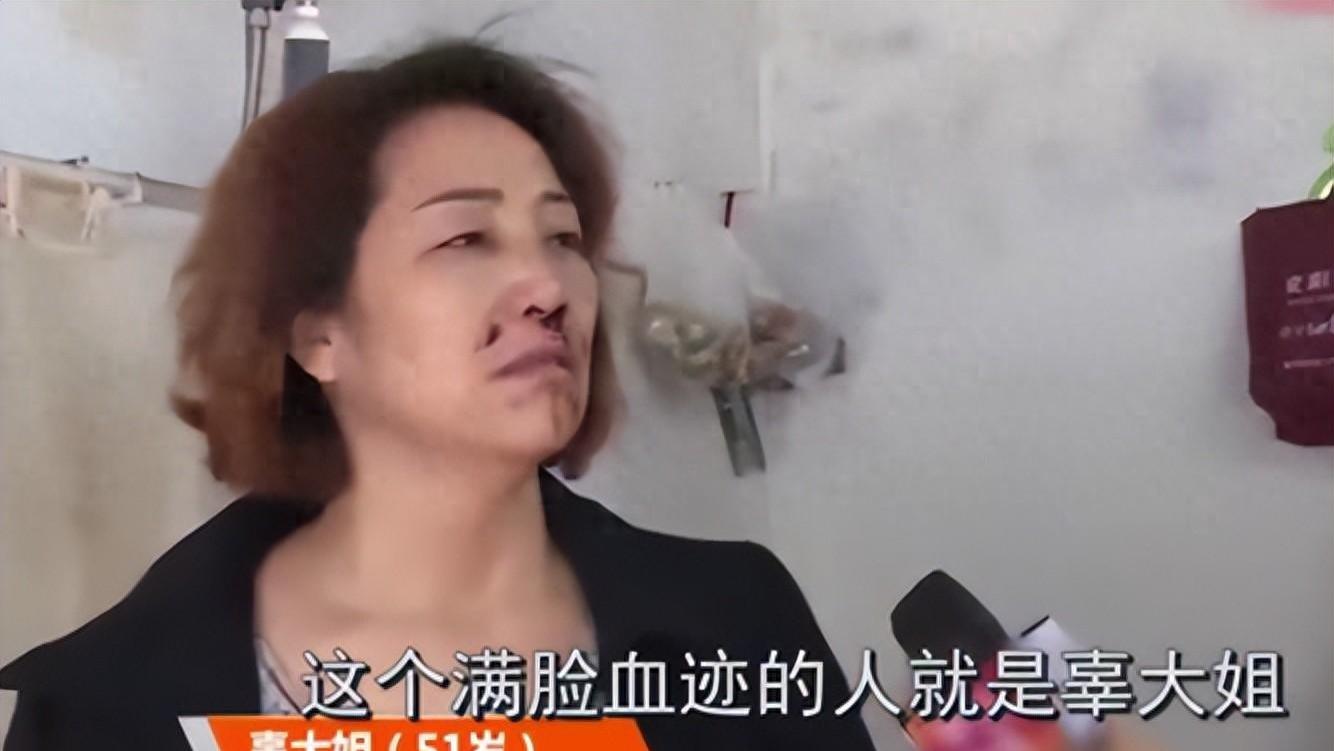 母亲没洗手抱孙子，被亲儿子打成脑震荡，母亲：必须得让他坐牢