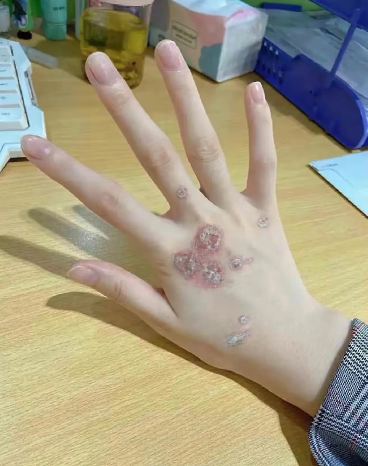 结婚前爆发了，婚礼都取消了，以后的日子会更好