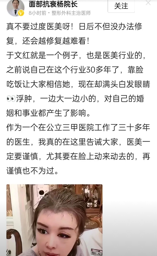 终于有专业的公立三甲医院的专业整形外科主治医师，对虞美人会长于文红过度医美看不下