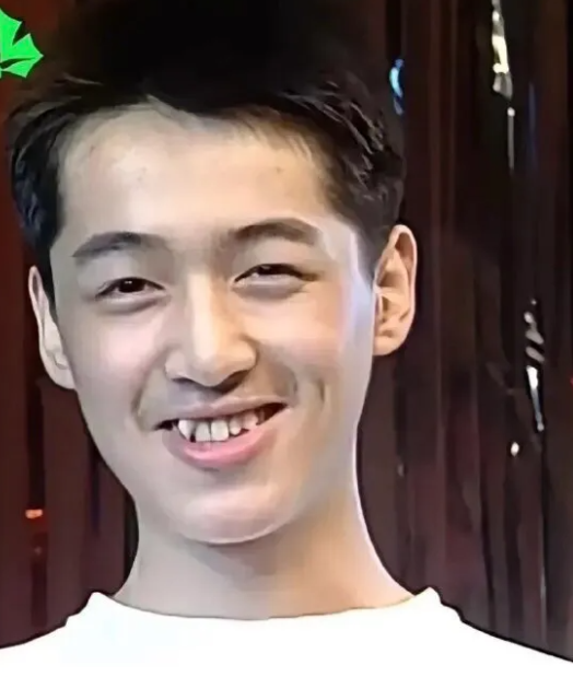 没想到胡歌以前牙齿这么乱，整牙后简直换了个人