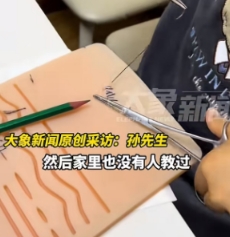 北京一8岁男孩，爱好竟然是外科手术缝合。家里没有人是医生，也没有教过孩子这种东西