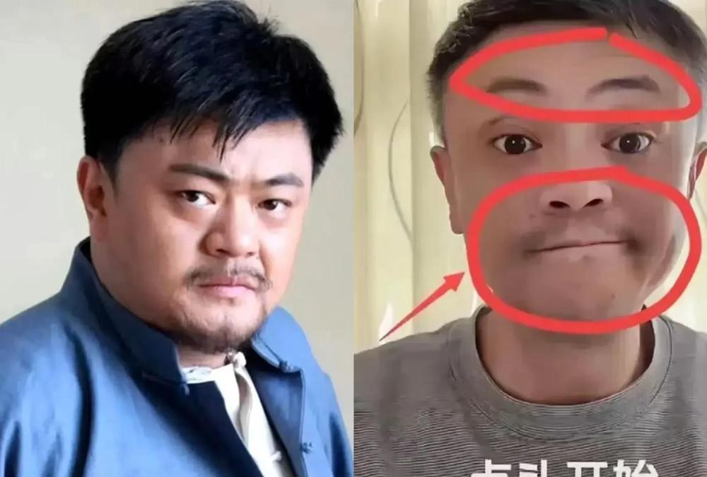 高亮真是太瘦了，医生朋友说过得扛15斤！

高亮如果再重个15斤，这次就扛过去了