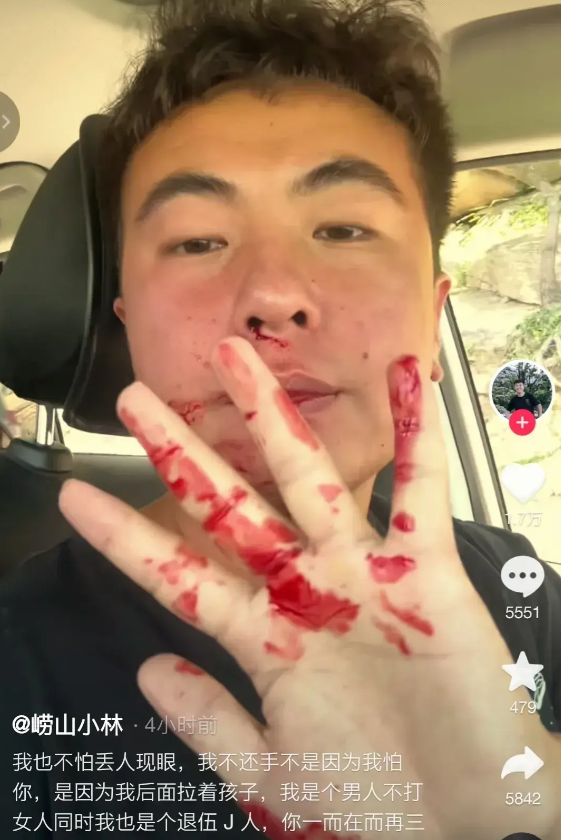 崂山路虎女子也后悔了。
第一，她爸妈估计得气到住院。主要是被周围邻居嘲笑，再加上