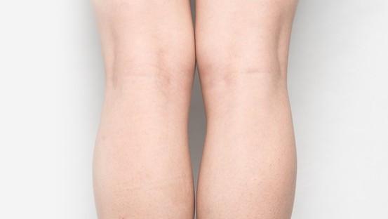 腿粗的人别烦恼！研究发现：大腿粗才是“宝藏身材”，更长寿！