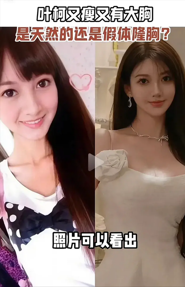 叶珂的假胸隆得比肚子还大,都垂到腰了,黄晓明要注意什么?(叶珂 整容)-第7张图片-九妖电影 叶珂的假胸隆得比肚子还大,都垂到腰了,黄晓明要注意什么?(叶珂 整容)-第7张图片-九妖电影