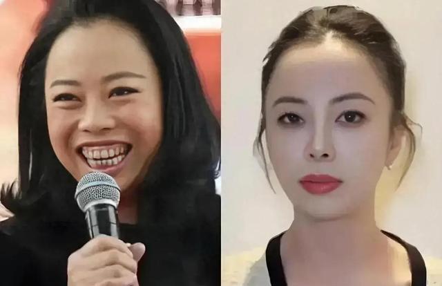 黄绮珊医美太漂亮，惊艳亮相如回春，网友惊呼：简直是换了一个人（黄绮珊近况）-第2张图片-九妖电影