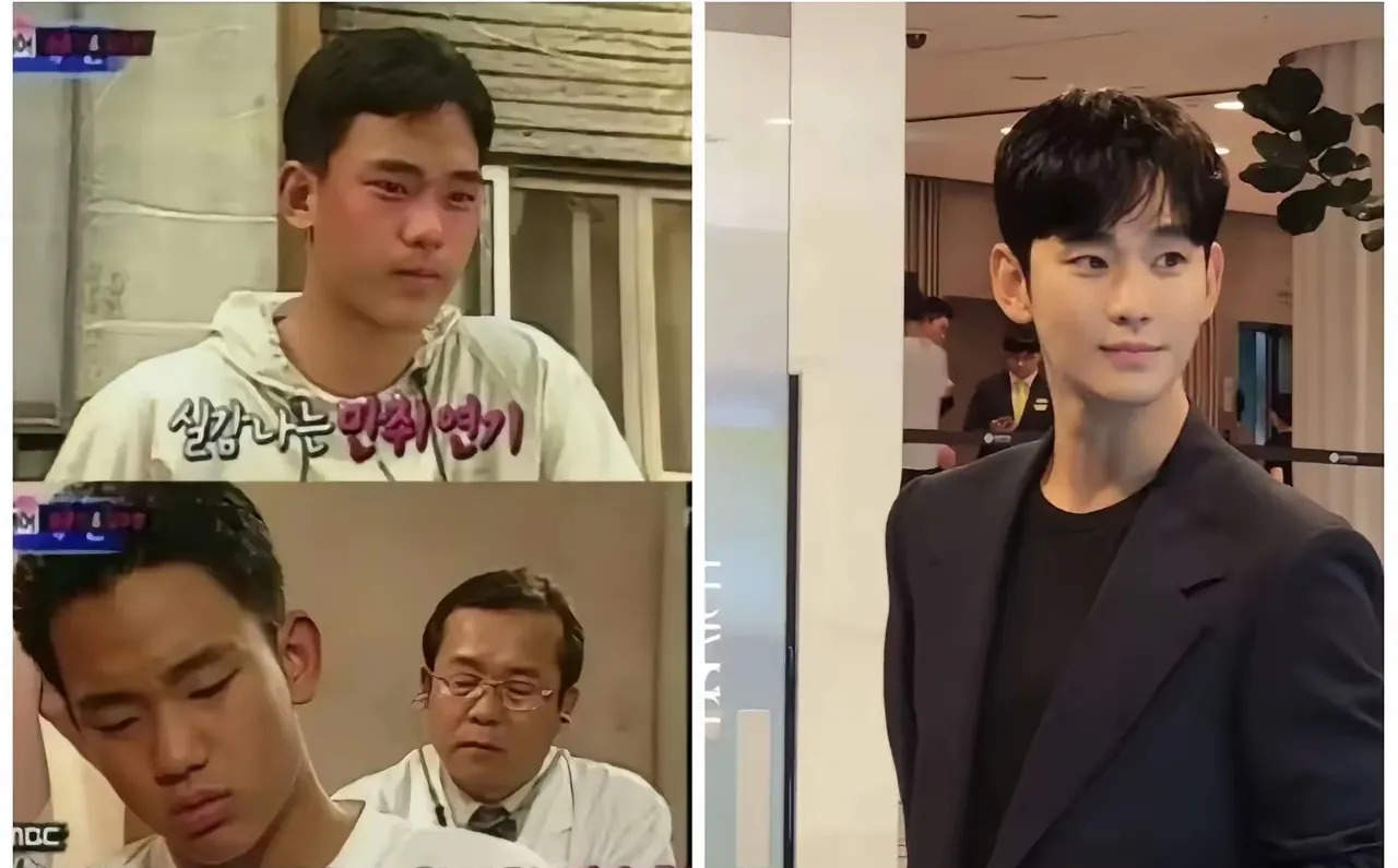男星整容引争议











金秀贤整容后遗症明显，脸部僵硬，比例失调，