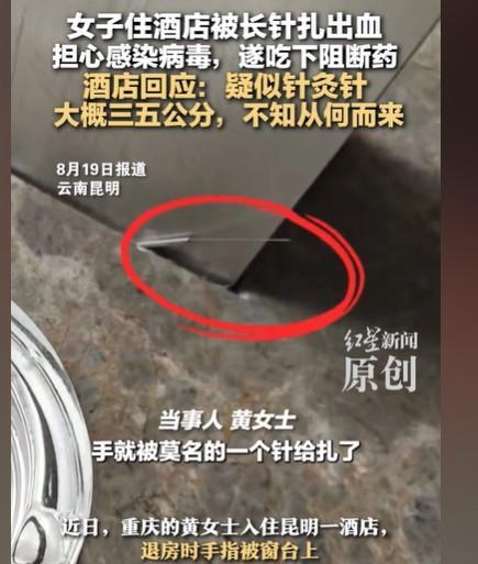 重庆，女子住酒店，退房的时候，从窗台拿包，结果被一根约5公分长的针给扎到了，她瞬