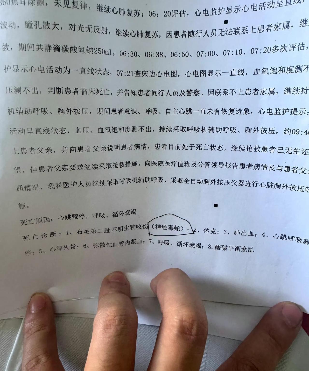 三亚被咬伤身亡女子家属说已有死亡诊断：确认右足第二趾为神经毒蛇咬伤
也回应了到底