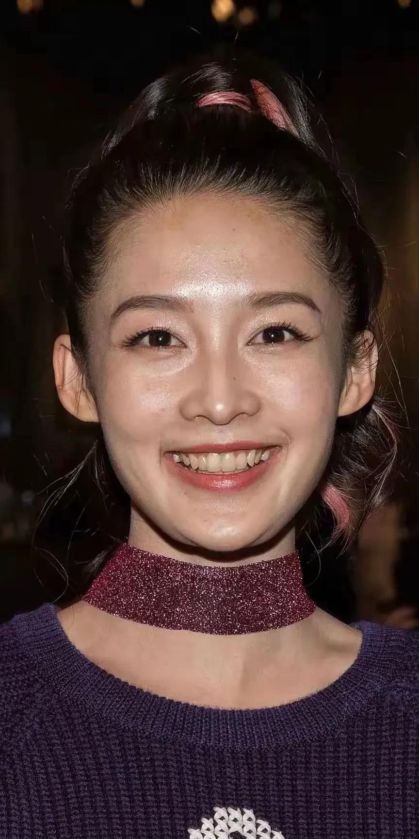 这是同一个人吗，这个女艺在这两张照片上相差实在是太大了。
没有美颜滤镜，她皮肤发