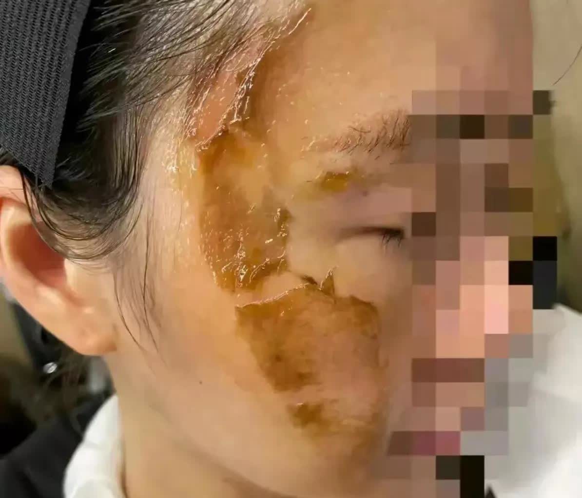 太闹心了！广东广州，有一名女子在网上求助，她因为在厨房炸鱼的时候，大鱼下油锅拼命