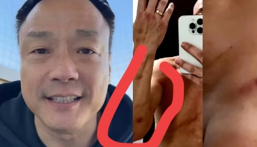 香港艺人王喜，因主演《烈火雄心》而成名，近几日在社交平台上公开了自己的健康检查报