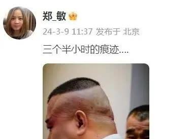 “郑敏，岳云鹏的妻子，分享了一张郭德纲的照片。那是老郭唱完戏，卸妆下来，头皮上刀