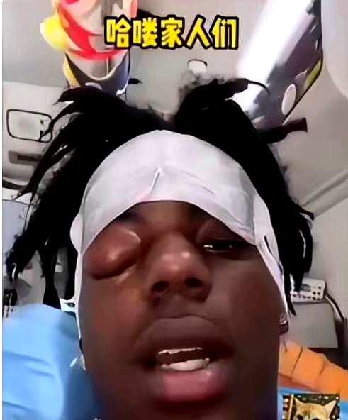 甲亢哥这回玩大了？

美国网红“甲亢哥”，粉丝3700万那位，最近摊上事了。