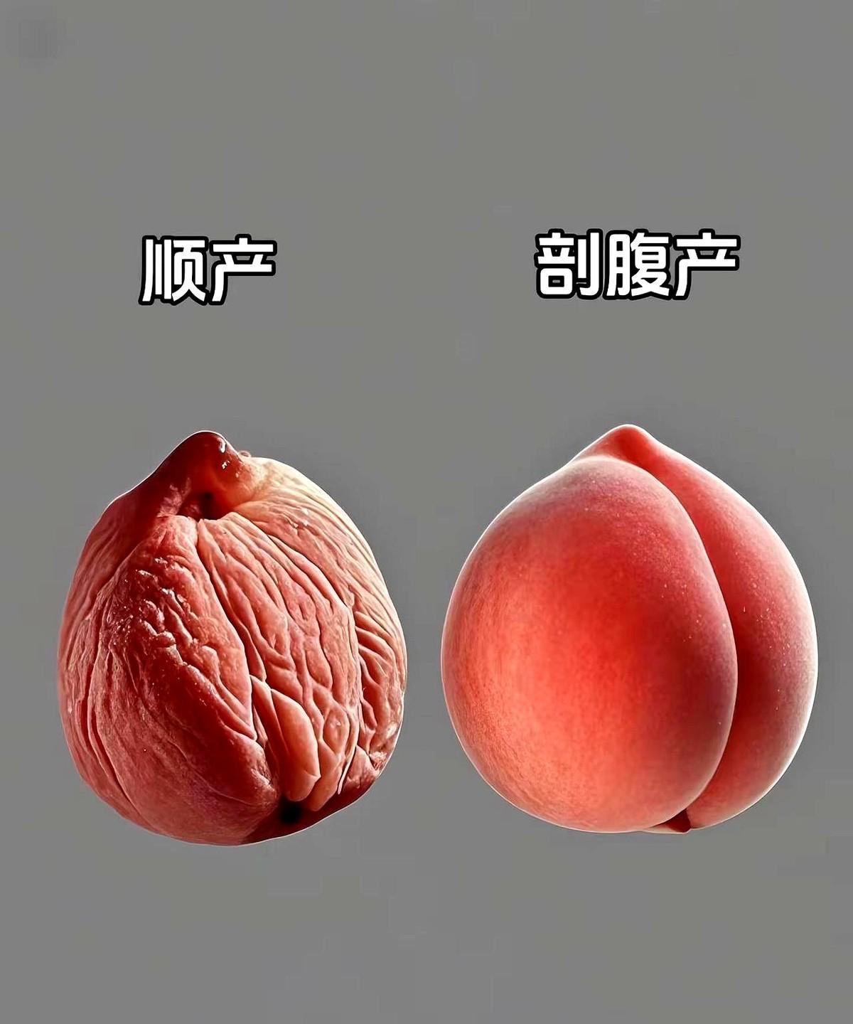 终于知道医生为啥都劝能顺就顺！你觉得是剖腹好还是顺的好呢？
那天跟产科闺蜜唠嗑，