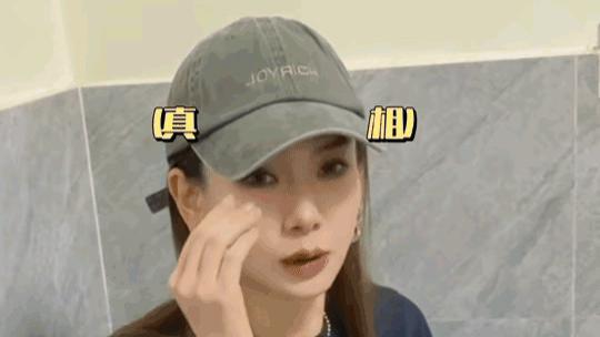 戚薇也太勇了！回应眼睛怎么了，大大方方承认做了皮肤管理！