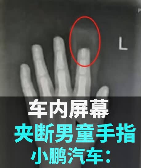 从小鹏 X9 事件看车企创新与安全的失衡
