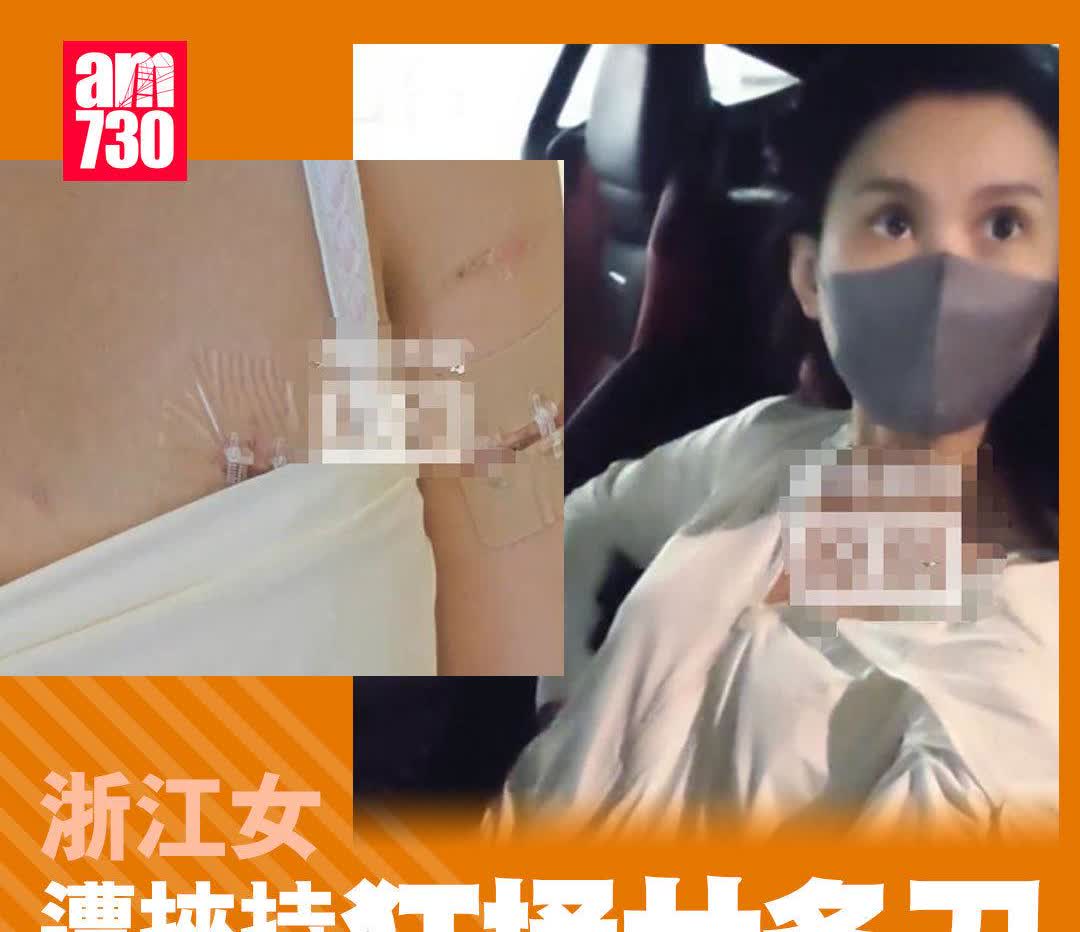 女子被捅，填充物救命！

浙江省杭州市一名女子，日前在商场遭陌生男子持刀挟持