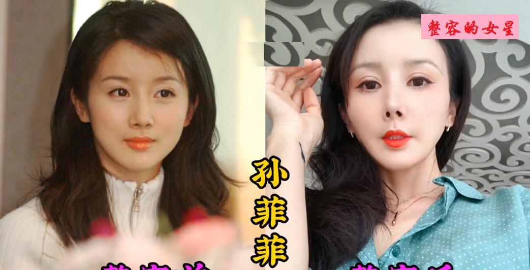 被整容害惨的18位女星，刚出道时她们个个俊美俏丽，就是因为太贪心了，总想着还能更