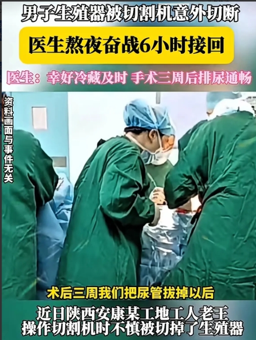 陕西安康，某工地上，工人老王在工地上干活时，不小心让切割机掉落，他的阴茎被切割掉