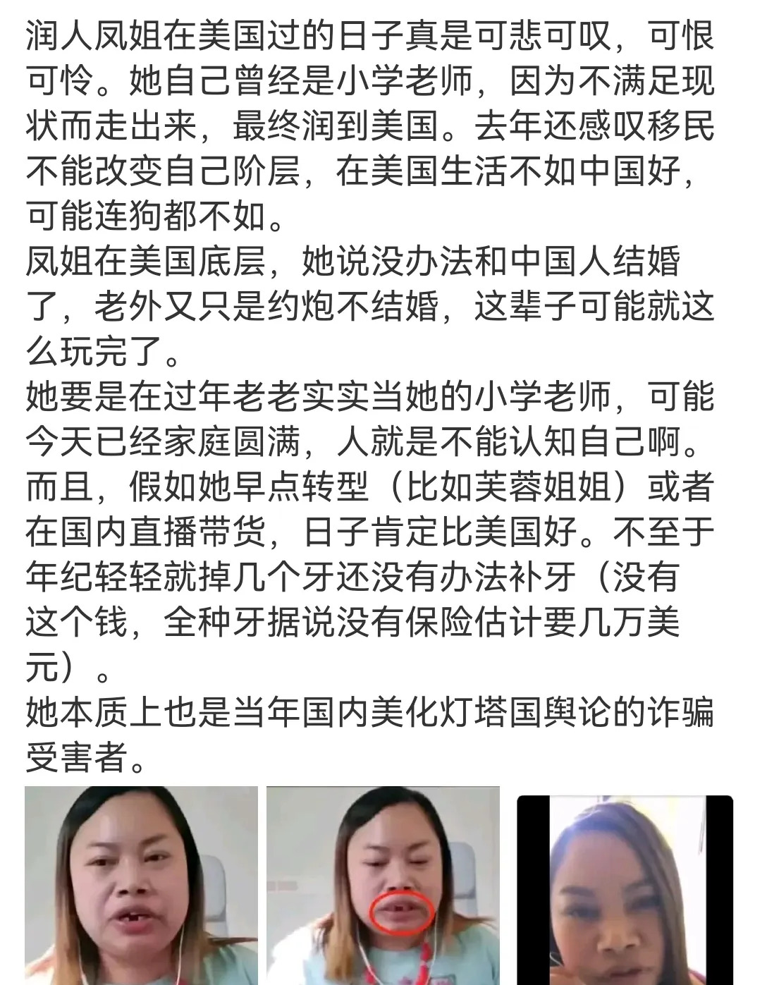 赴美移民，人生尽毁











我滴个神啊！你敢信吗？一个人为了“美国