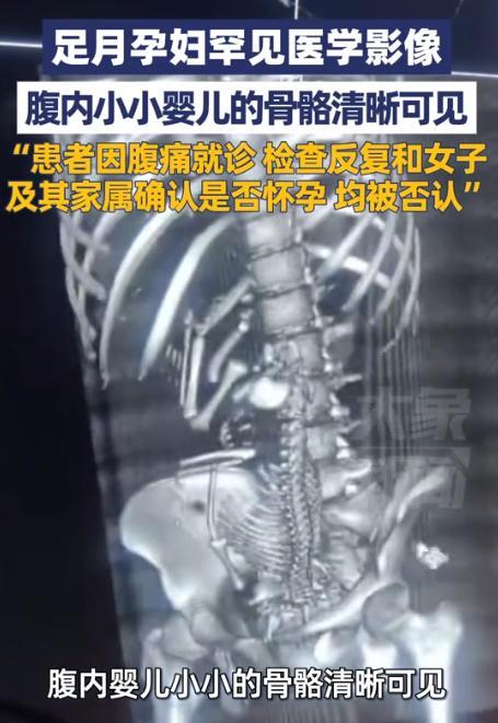 近日，19岁女子腹痛去医院，医生反复跟她和家属确认是否怀孕，都得到否认答复。可影