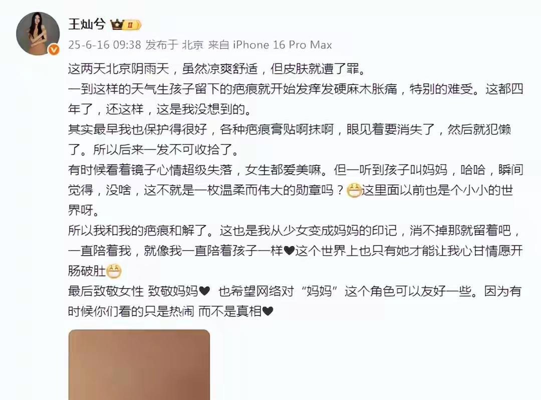 当镜子里那道明显的剖腹产疤痕映入眼帘，你会如何面对？王灿的选择让人动容。她晒出自