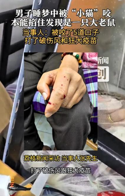 “太悲剧了！”深夜，无锡某小区，张先生睡梦中被老鼠袭击。



凌晨，熟睡的张先