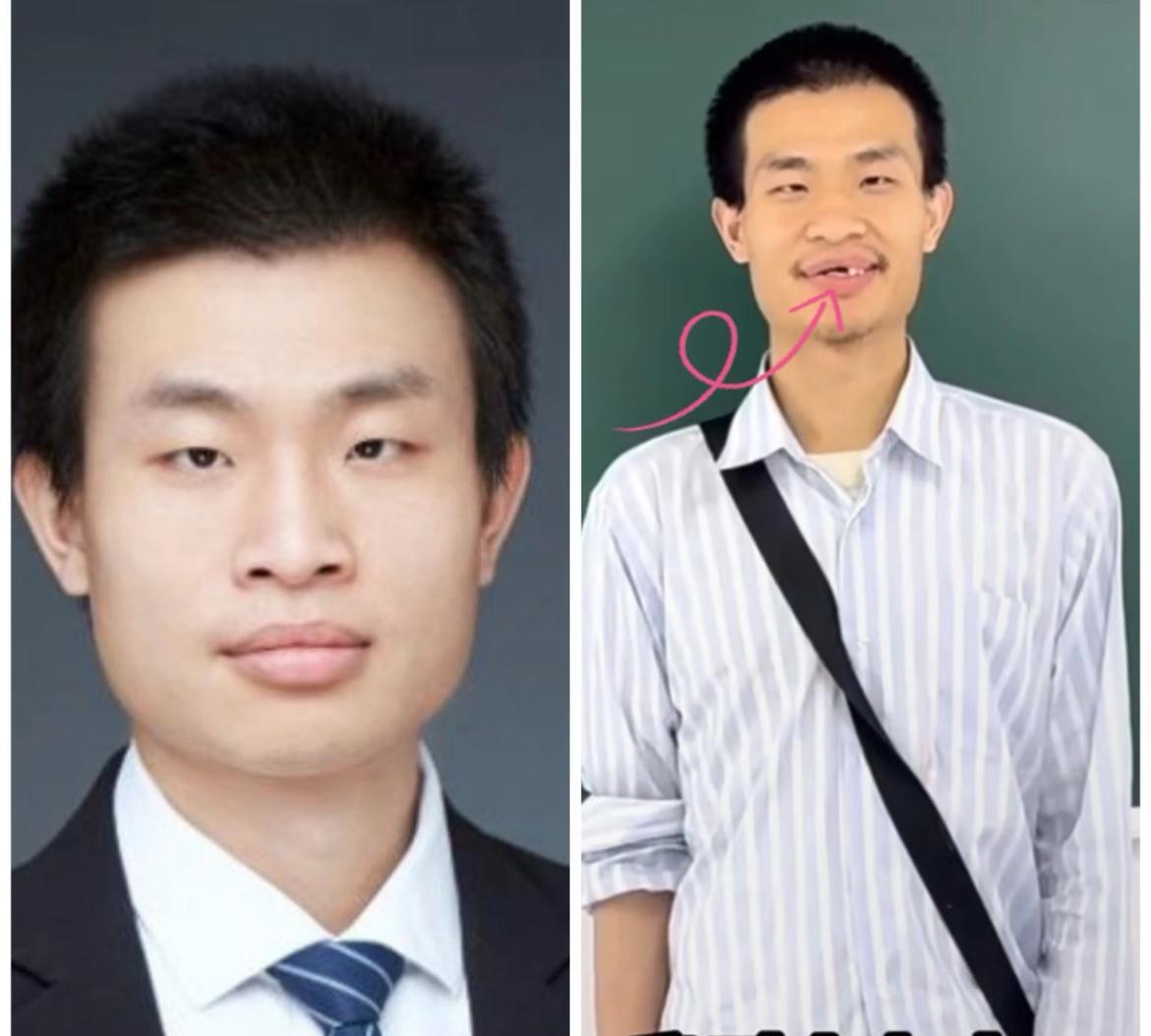 其实现在应该关心的是他的自身状况，他牙齿已经掉了几颗了，他脑力工作强度那么大，要