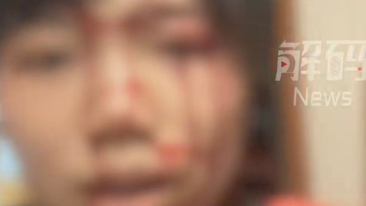 女子被男同事砸毁容反转，疑偷听同事电话撬客户，事后还挖苦嘲讽