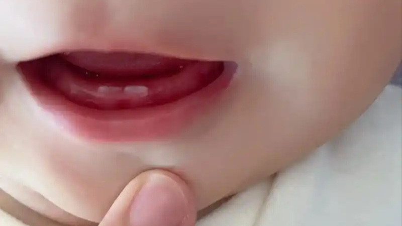 宝宝出牙晚？别急着补钙，找准原因才是关键