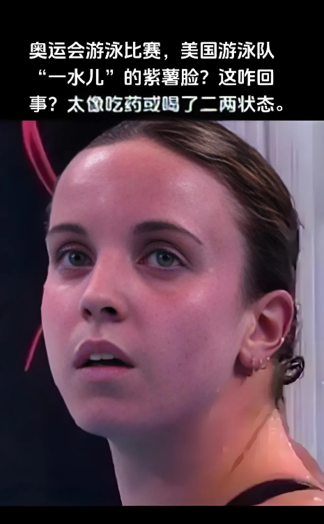 美国游泳队宣称集体食物中毒，然后申请新加坡游泳世锦赛集体医疗豁免。

看样子是磕